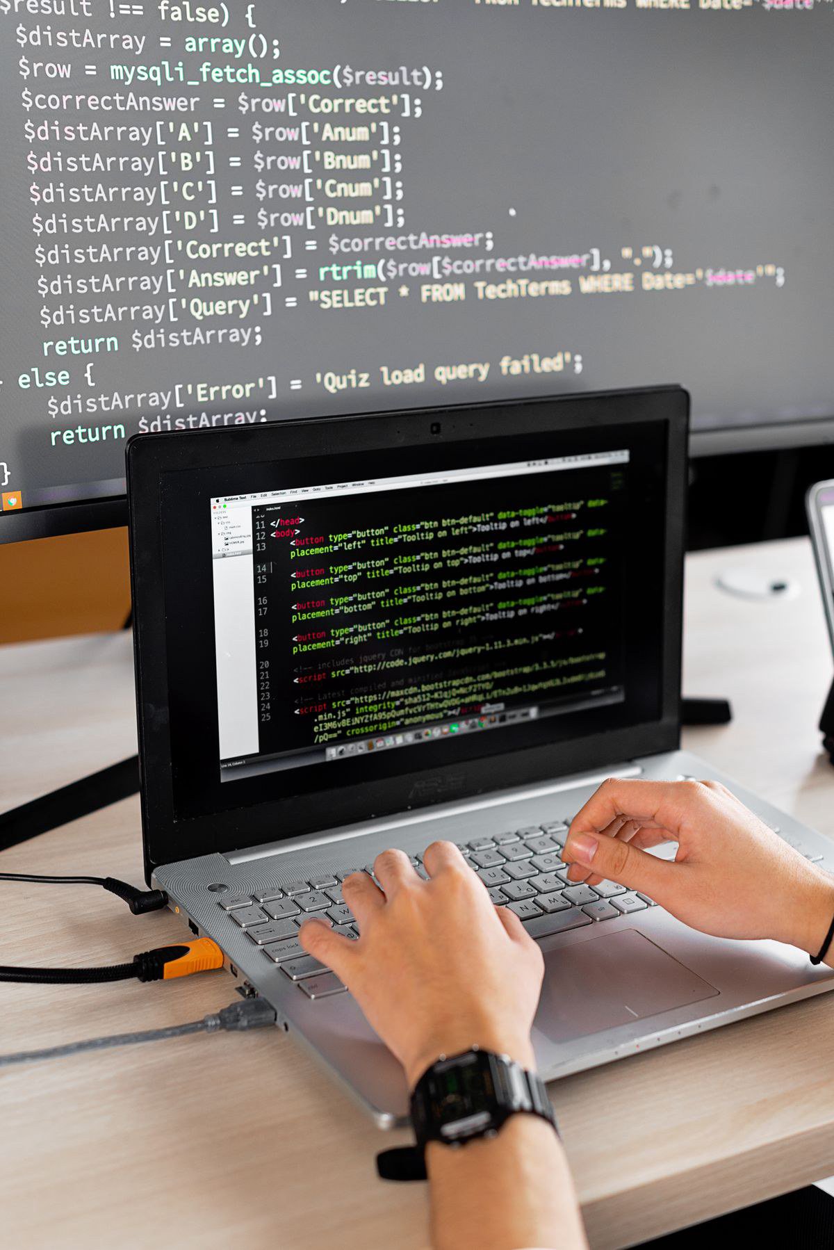 Ngồi lâu trước màn hình âm thầm tàn phá đôi chân của developer